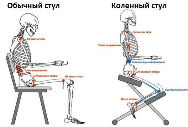 Показания к использованию коленного стула, его разновидности 1 - ДиванеТТо