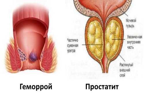 Предназначение ортопедической подушки на стул, ее конструкция 9 - ДиванеТТо